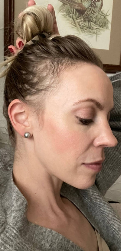 Before - Emily R.