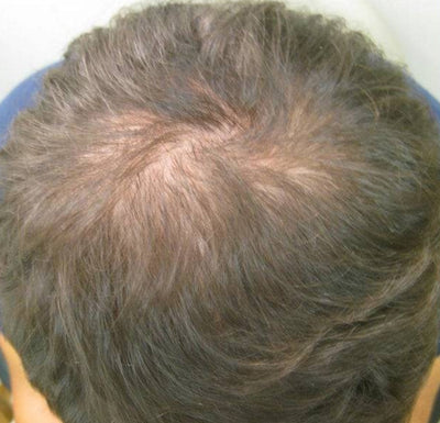 Before - Ronald K.